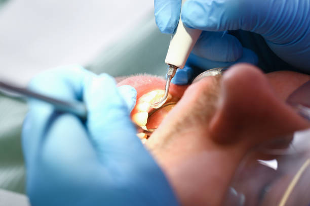 Best Emergency Tooth Extraction  in Green Cove Springs, FL